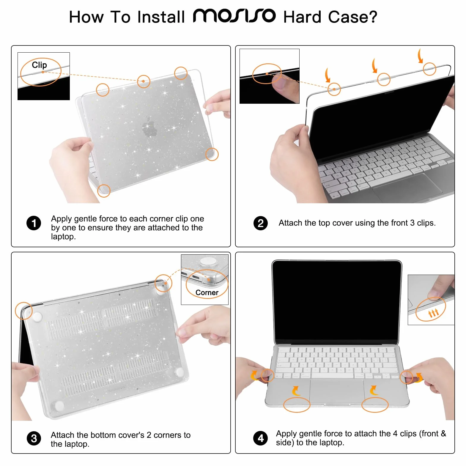 MOSISO Coque Pailletée Brillante Compatible MacBook Neo 13 Pouces 2026 A3404 Puce A18 Pro, Rigide Antifissure, Film Clavier, Protection Écran & Sac Rangement Transparent